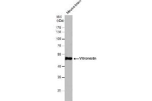WB Image Vitronectin antibody detects Vitronectin protein by western blot analysis. (Vitronectin Antikörper)