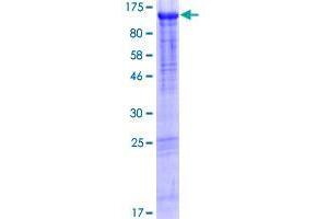 Image no. 1 for Glutamine-Rich 1 (QRICH1) (AA 1-776) protein (GST tag) (ABIN1317009) (QRICH1 Protein (AA 1-776) (GST tag))