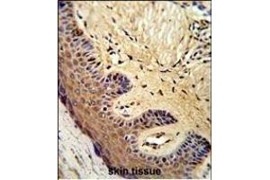 Formalin-fixed and paraffin-embedded human skin reacted with MC Antibody (Center), which was peroxidase-conjugated to the secondary antibody, followed by DAB staining. (MCAM Antikörper  (AA 161-189))