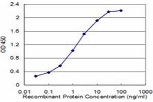 Detection limit for recombinant GST tagged LDLR is approximately 0. (LDLR Antikörper  (AA 105-205))