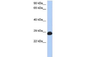 WB Suggested Anti-RAB39B Antibody Titration: 0. (RAB39B Antikörper  (N-Term))