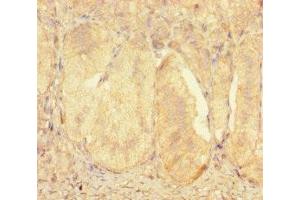Immunohistochemistry of paraffin-embedded human adrenal gland tissue using ABIN7176128 at dilution of 1:100 (ZNF175 Antikörper  (AA 1-711))