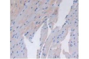 Detection of CD26 in Mouse Heart Tissue using Polyclonal Antibody to Cluster Of Differentiation 26 (CD26) (DPP4 Antikörper  (AA 29-178))