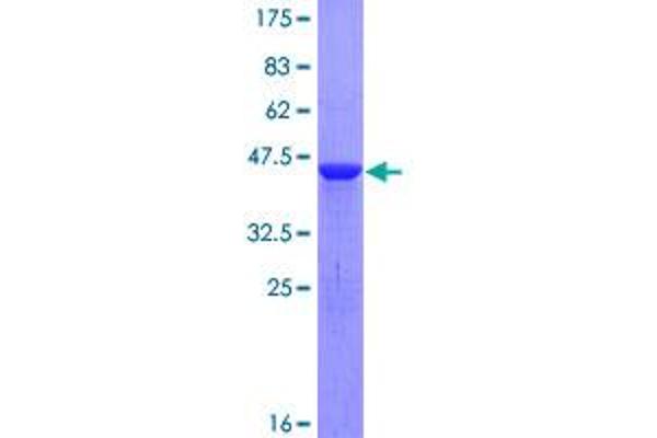 Cofilin 2 Protein (CFL2) (AA 1-166) (GST tag)