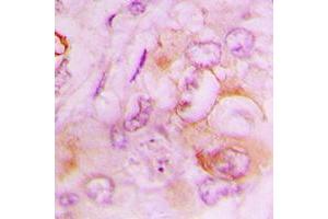 Immunohistochemistry (IHC) image for anti-serpin Peptidase Inhibitor, Clade B (Ovalbumin), Member 9 (SERPINB9) (Center) antibody (ABIN7296590)