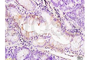 Formalin-fixed and paraffin embedded: rat colitis tissue labeled with Anti-PDGFRA Polyclonal Antibody, Unconjugated (ABIN726620) at 1:200, followed by conjugation to the secondary antibody and DAB staining (PDGFRA Antikörper  (AA 1021-1089))