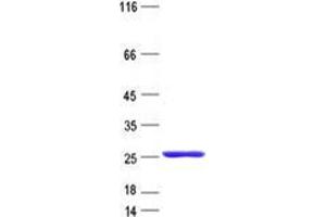 Validation with Western Blot (BCL7A Protein (His tag))