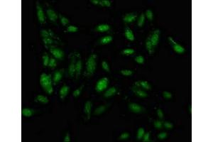 Immunofluorescence staining of Hela cells with ABIN7156618 at 1:100, counter-stained with DAPI. (IRF2BP1 Antikörper  (AA 340-499))