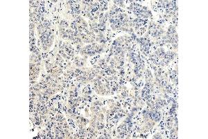 IHC analysis of RBP4 using anti-RBP4 antibody (ABIN5519056).