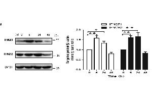 IFN-γ increased rates of autophagy in primary BMECs in vitro. (RTN4RL2 Antikörper  (AA 241-337))