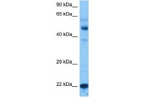 Host:  Rabbit  Target Name:  NTM1A  Sample Tissue:  Large Intestine Tumor lysates  Antibody Dilution:  1ug/ml