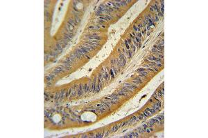 Immunohistochemistry (Paraffin-embedded Sections) (IHC (p)) image for anti-Wingless-Type MMTV Integration Site Family, Member 10B (WNT10B) (AA 193-222) antibody (ABIN390524)