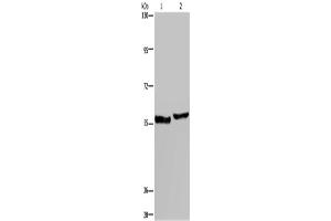 Western Blotting (WB) image for anti-Solute Carrier Family 1 (High Affinity Aspartate/glutamate Transporter), Member 6 (SLC1A6) antibody (ABIN2431275)