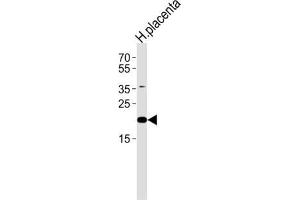 Western Blotting (WB) image for anti-Chromosome 2 Open Reading Frame 74 (C2ORF74) antibody (ABIN3004714)