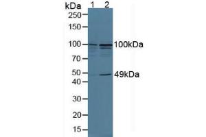 Figure. (TNIP2 Antikörper  (AA 170-413))