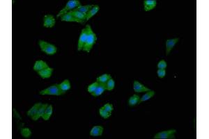 Immunofluorescence staining of HepG2 cells with ABIN7147616 at 1:100, counter-stained with DAPI. (Choline Kinase alpha Antikörper  (AA 79-173))
