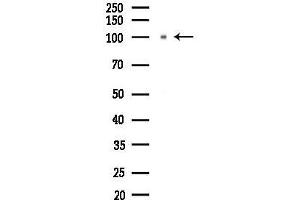 Western blot analysis of lysates from Hela cells(starvation 24h treatment), using DCN Antibody at 1/1000 dilution.
