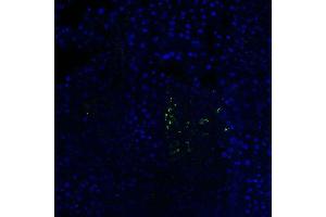 Mouse Pancreas (C57BL/6 strain) fixed in 4% PFA for 2 hours at RT, then transferred to 30% sucrose overnight at 4 °C before embedding in OCT mounting medium. (Somatostatin Antikörper  (AA 75-107))