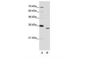Image no. 1 for anti-Proteasome Subunit alpha Type 1 (PSMA1) (N-Term) antibody (ABIN203038) (PSMA1 Antikörper  (N-Term))