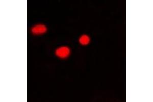 Immunofluorescent analysis of PSMB10 staining in Hela cells. (PSMB10 Antikörper)