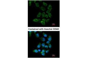 ICC/IF Image Immunofluorescence analysis of paraformaldehyde-fixed A431, using USP15, antibody at 1:200 dilution.