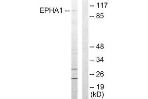 Western blot analysis of extracts from COLO205 cells, using EPHA1 antibody. (EPHA1 Antikörper  (Internal Region))
