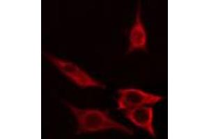 ABIN6267676 staining COLO205 cells by IF/ICC. (B-Cell Linker Antikörper  (pTyr96))
