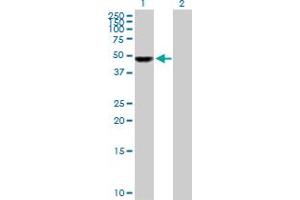 Western Blot analysis of UCKL1 expression in transfected 293T cell line by UCKL1 MaxPab polyclonal antibody. (UCKL1 Antikörper  (AA 1-419))