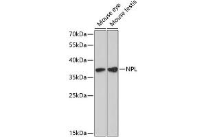 Western blot analysis of extracts of various cell lines, using NPL antibody (ABIN6132931, ABIN6144778, ABIN6144779 and ABIN6224929) at 1:3000 dilution.