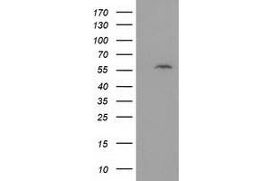 HEK293T cells were transfected with the pCMV6-ENTRY control (Left lane) or pCMV6-ENTRY DTNA (Right lane) cDNA for 48 hrs and lysed. (DTNA Antikörper)