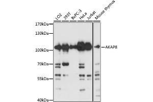 Western blot analysis of extracts of various cell lines, using  antibody (ABIN3017254, ABIN3017255, ABIN3017256 and ABIN6220015) at 1:3000 dilution. (AKAP8 Antikörper  (AA 480-692))