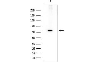 anti-Acyl-CoA Thioesterase 2 (ACOT2) (Internal Region) antibody