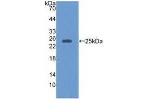 Detection of Recombinant EBI3, Human using Monoclonal Antibody to Epstein Barr Virus Induced Protein 3 (EBI3) (EBI3 Antikörper  (AA 21-229))