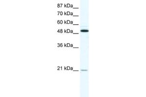 Western Blotting (WB) image for anti-Tumor Necrosis Factor Receptor Superfamily, Member 11b (TNFRSF11B) antibody (ABIN2463647) (Osteoprotegerin Antikörper)