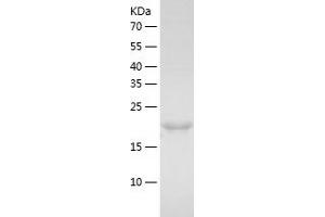 MAD2L1 Protein (AA 1-205) (His tag)