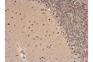 IHC-P Image CSB antibody [N2C1], Internal detects CSB protein at nucleus on rat hind brain by immunohistochemical analysis.