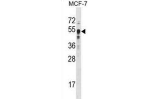 Western Blotting (WB) image for anti-SET Domain Containing 8 Pseudogene 1 (SETD8P1) antibody (ABIN2996451) (SET7 Antikörper)
