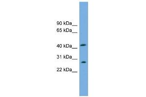 WB Suggested Anti-RABEPK Antibody Titration: 0. (RABEPK Antikörper  (N-Term))