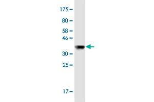 Western Blotting (WB) image for anti-Optic Atrophy 1 (Autosomal Dominant) (OPA1) (AA 851-960) antibody (ABIN2565745)