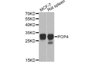 Western blot analysis of extracts of various cell lines, using POP4 Antibody. (RPP29 Antikörper)