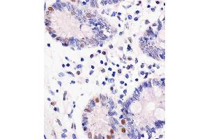 (ABIN6243211 and ABIN6577174) staining GDH in human colon tissue sections by Immunohistochemistry (IHC-P - paraformaldehyde-fixed, paraffin-embedded sections).