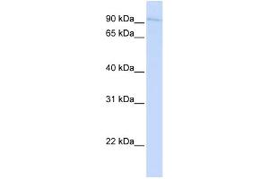 WB Suggested Anti-SYDE1 Antibody Titration:  0. (SYDE1 Antikörper  (N-Term))