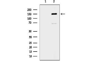 anti-ATP-Binding Cassette, Sub-Family A (ABC1), Member 8 (ABCA8) (Internal Region) antibody