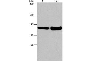 Western Blot analysis of Mouse lung and liver tissue using MAPRE3 Polyclonal Antibody at dilution of 1:1050 (MAPRE3 Antikörper)