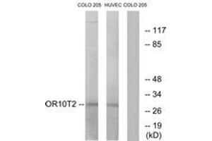 Western blot analysis of extracts from HuvEc/COLO cells, using OR10T2 Antibody. (OR10T2 Antikörper  (AA 231-280))