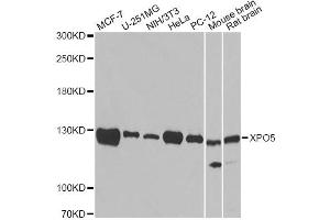 Western blot analysis of extracts of various cell lines, using XPO5 antibody (ABIN5974114).