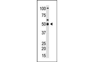 Image no. 1 for anti-YY1 Transcription Factor (YY1) (N-Term) antibody (ABIN357756) (YY1 Antikörper  (N-Term))