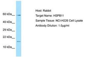 Image no. 1 for anti-Heat Shock Protein Family B (Small), Member 11 (HSPB11) (AA 6-55) antibody (ABIN6749885) (HSPB11 Antikörper  (AA 6-55))