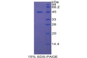 SDS-PAGE (SDS) image for Uncoupling Protein 1 (Mitochondrial, Proton Carrier) (UCP1) (AA 179-296) protein (His tag,GST tag) (ABIN1981182)