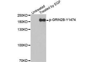 Western blot analysis of extracts from A431 cells, using Phospho-GRIN2B-Y1474 antibody. (GRIN2B Antikörper  (pTyr1474))
